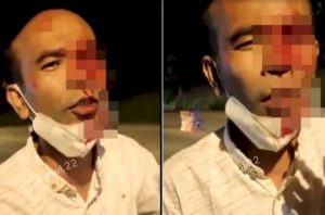 Sosok Awaluddin, Ngaku Matanya Ditusuk di Penyekatan, Oh Ternyata