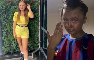 Wajah Wanita Ini Berubah Jadi Hijau, Teman Mengira ‘Hulk’, Ternyata…